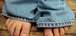 صورة: كيفية علاج تورم الأصابع و أسباب تورم الأصابع