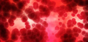 ارتفاع كريات الدم الحمراء في البول و أسباب ارتفاع كريات الدم الحمراء في البول صورة: ارتفاع كريات الدم الحمراء في البول و أسباب ارتفاع كريات الدم الحمراء في البول