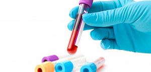 صورة: تحليل تروبونين و تفسير نتائج تحليل تروبونين