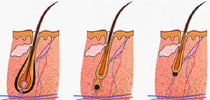 صورة: الشعر و مراحل نمو الشعر و مكونات الشعرة