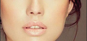 صورة: الهالات السوداء و طرق طبيعية للتخلص من الهالات السوداء