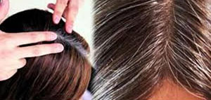 زيت البيض و زيت الأرنيكا و عصير الجزر صورة: زيت البيض و زيت الأرنيكا و عصير الجزر