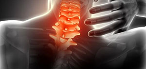 صورة: أعراض ديسك الرقبة و دواعي مراجعة الطبيب