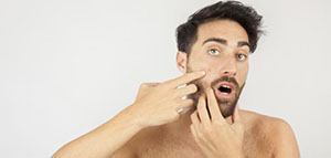 صورة: طريقة طبية لبقع حب الشباب البنية و وصفات لبقع حب الشباب البنية