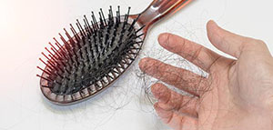 طرق طبية لمنع تساقط الشعر و طرق طبيعية لمنع تساقط الشعر صورة: طرق طبية لمنع تساقط الشعر و طرق طبيعية لمنع تساقط الشعر