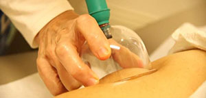 صورة: الحجامة و فوائد الحجامة الصحية