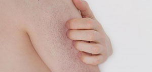 صورة: الكريمات المزيلة لخلايا الجلد الميتة و الكريمات التي تمنع سد المسامات