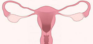 صورة: أضرار ربط الرحم لمنع الحمل و بعد إجراء ربط الرحم لمنع الحمل