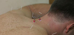 صورة: العلاجات الطبيعية و العلاجات الدوائية[d]24