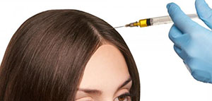 حقن البلازما و حقن البلازما للشعر و عملية تحضير حقن البلازما صورة: حقن البلازما و حقن البلازما للشعر و عملية تحضير حقن البلازما