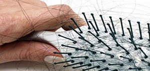 صورة: تساقط الشعر و أسباب صحية وطبية لتساقط الشعر