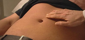 فتق السرة و أعراض فتق السرة و أسباب فتق السرة صورة: فتق السرة و أعراض فتق السرة و أسباب فتق السرة