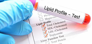 تحليل HDL و دواعي استخدام تحليل HDL و تعليمات إجراء تحليل HDL صورة: تحليل HDL و دواعي استخدام تحليل HDL و تعليمات إجراء تحليل HDL