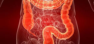 صورة: اضطرابات الجهاز الهضمي و غسيل القولون