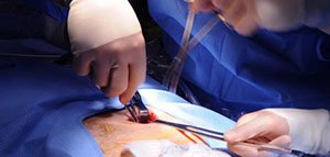 صورة: فتق البطن و أنواع فتق البطن و عوامل خطر الإصابة بفتق البطن