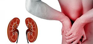 صورة: الفشل الكلوي و أعراض الفشل الكلوي و أسباب الفشل الكلوي