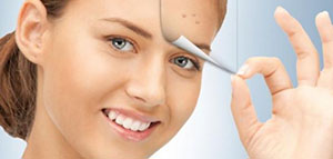 صورة: الفيتامينات وحب الشباب و أفضل فيتامين لحب الشباب