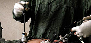 صورة: جراحة المنظار و نشأة جراحة المنظار و ميزات جراحة المنظار