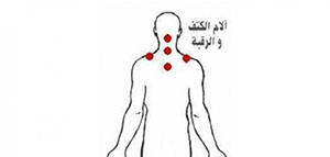 صورة: الحجامة و معلومات عن الحجامة