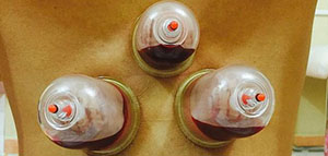 صورة: الحجامة[d]18