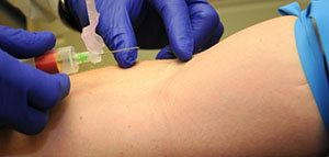 تحليل tsh للنساء و القيم الطبيعية لتحليل tsh للنساء صورة: تحليل tsh للنساء و القيم الطبيعية لتحليل tsh للنساء