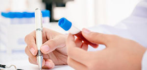 كورونا صورة: كورونا