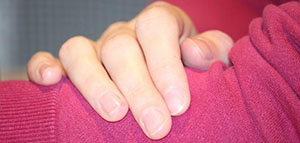 استخدام مزيج الخل وعصير الليمون لإزالة المناكير صورة: استخدام مزيج الخل وعصير الليمون لإزالة المناكير