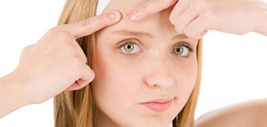 صورة: علاج الحب الشبابي و العوامل التي تساعد على تهيج حب الشباب