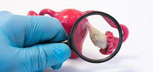 صورة: الأكياس الوظيفية و الأكياس المرضية