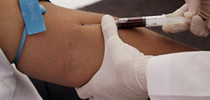 ما هو تحليل LDH و دواعي إجراء فحص LDH صورة: ما هو تحليل LDH و دواعي إجراء فحص LDH