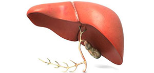 التهاب الكبد C و مراحل الإصابة بالتهاب الكبد C صورة: التهاب الكبد C و مراحل الإصابة بالتهاب الكبد C