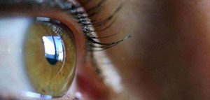 صورة: التراخوما