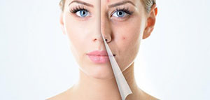 هل يمكن التخلص من حب الشباب دون أدوية و إجراءات طبية للتخلص من حب الشباب صورة: هل يمكن التخلص من حب الشباب دون أدوية و إجراءات طبية للتخلص من حب الشباب