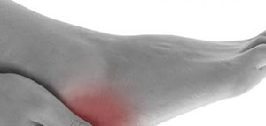 زيادة الأملاح في الجسم صورة: زيادة الأملاح في الجسم