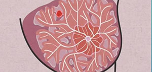 غدد الثدي و أسباب ظهور غدة في الثدي و علامات ظهور غدة في الثدي صورة: غدد الثدي و أسباب ظهور غدة في الثدي و علامات ظهور غدة في الثدي