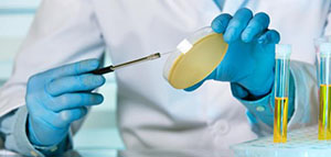 أسباب الالتهاب في مجرى البول و أعراض الالتهاب في مجرى البول صورة: أسباب الالتهاب في مجرى البول و أعراض الالتهاب في مجرى البول