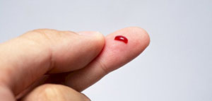 هل يمكن معرفة فصيلة الدم دون تحليل و معرفة فصيلة الدم من خلال التحليل صورة: هل يمكن معرفة فصيلة الدم دون تحليل و معرفة فصيلة الدم من خلال التحليل