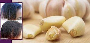 صورة: الثوم للشعر و فوائد الثوم لتطويل الشعر