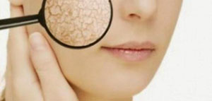 جفاف الوجه و وصفات طبيعية لجفاف الوجه صورة: جفاف الوجه و وصفات طبيعية لجفاف الوجه