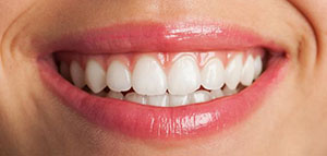 أعراض التهاب اللثة و أعراض تستوجب زيارة الطبيب صورة: أعراض التهاب اللثة و أعراض تستوجب زيارة الطبيب