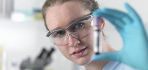 صورة: تحليل RDW CV و فيديو ما هو تحليل RDW