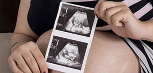 حركة الجنين صورة: حركة الجنين