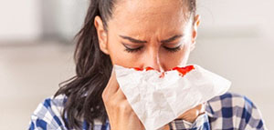 أسباب شائعة لنزول الدم من الأنف و أسباب غير شائعة لنزول الدم من الأنف صورة: أسباب شائعة لنزول الدم من الأنف و أسباب غير شائعة لنزول الدم من الأنف