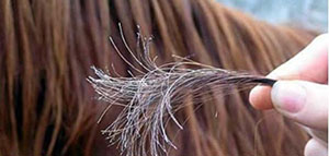 صورة: تقصف الشعر و نصائح لعلاج تقصف الشعر وتطويله