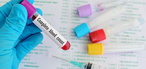 صورة: تحليل الدم للكشف عن مشاكل المرارة و تحليل البول للكشف عن مشاكل المرارة