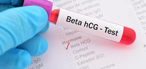 ما هو تحليل الدم الهرموني للحمل و دواعي إجراء تحليل الدم الهرموني للحمل صورة: ما هو تحليل الدم الهرموني للحمل و دواعي إجراء تحليل الدم الهرموني للحمل