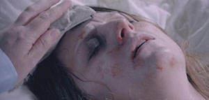 حمى التيفوئيد و أعراض الإصابة بحمى التيفوئيد صورة: حمى التيفوئيد و أعراض الإصابة بحمى التيفوئيد