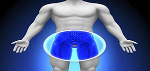 سرطان البروستاتا صورة: سرطان البروستاتا