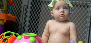 حمى البحر الأبيض المتوسط صورة: حمى البحر الأبيض المتوسط