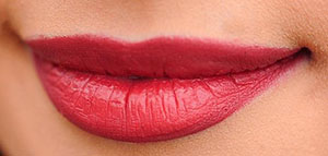 صورة: الحفاظ على فيلر الشفايف و عملية حقن الفيلر